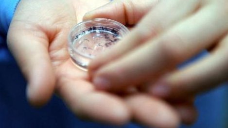 血值和卵泡不匹配所取卵子质量好吗？