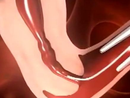 武汉试管医院试管婴儿价格多少？附费用列表？