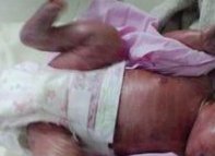 浅谈试管婴儿前为什么要做那么多检查，看完各项意义就知道