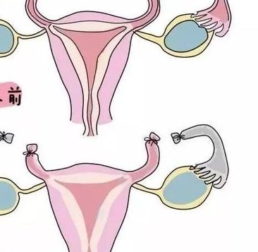 做试管促排卵泡不长怎么办？
